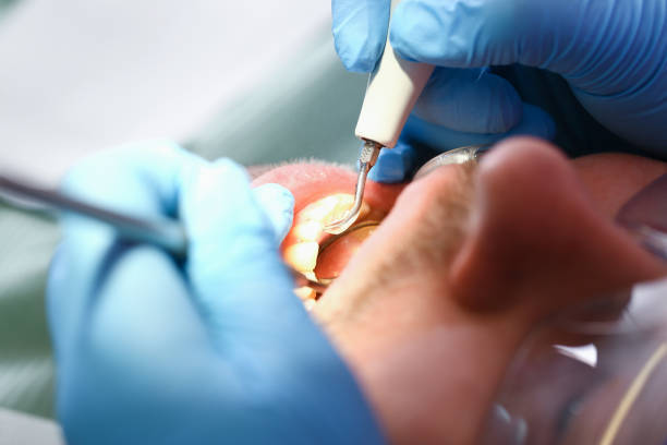 Best Emergency Broken Tooth Repair in Grinnell, IA