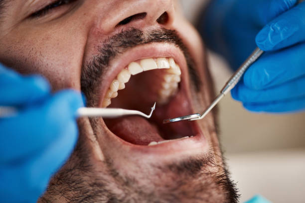 Best Walk-In Emergency Dentist in Grinnell, IA